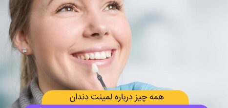 عکس لمینت دندان