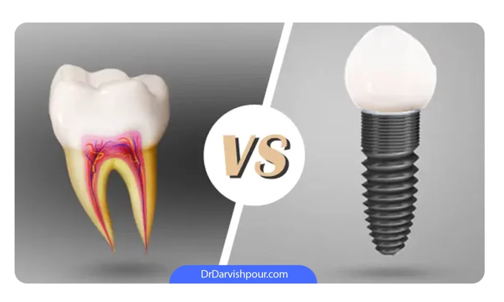 فرق روکش و ایمپلنت دندان