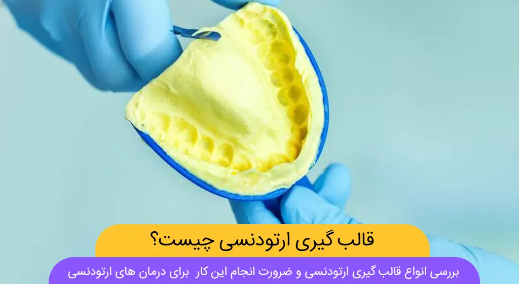 انواع روش قالب گیری ارتودنسی (دیجیتال و سنتی + توضیح مراحل) | دکتر ...