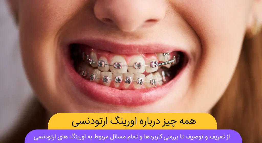 عکس اورینگ ارتودنسی