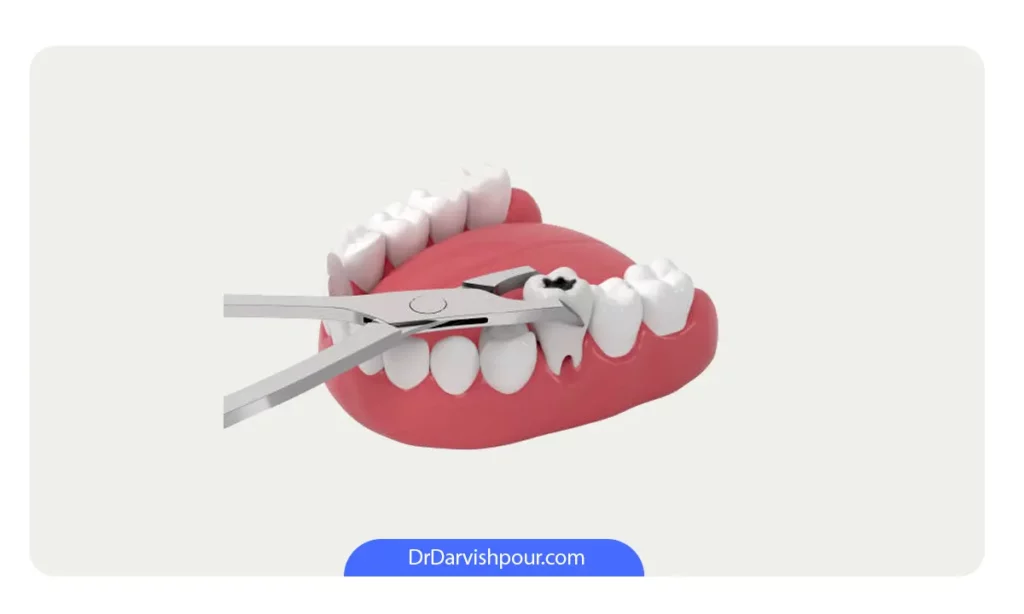 عکس کشیدن دندان