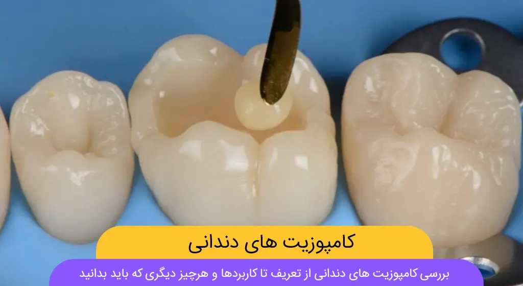 عکس کامپوزیت دندان