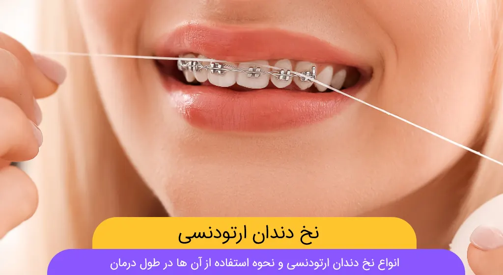 نخ دندان ارتودنسی عکس