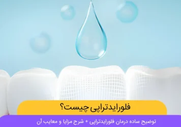 فلورایدتراپی شاخص