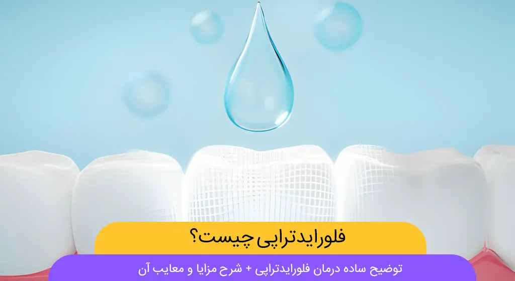 فلورایدتراپی شاخص