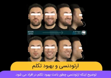 ارتودنسی و تکلم شاخص