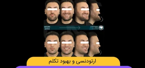 ارتودنسی و تکلم شاخص