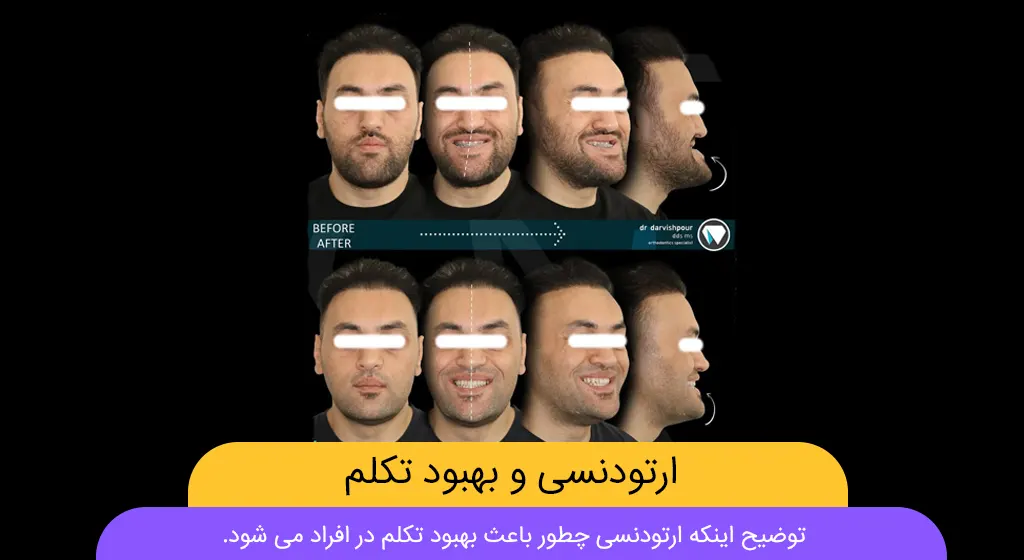 ارتودنسی و تکلم شاخص